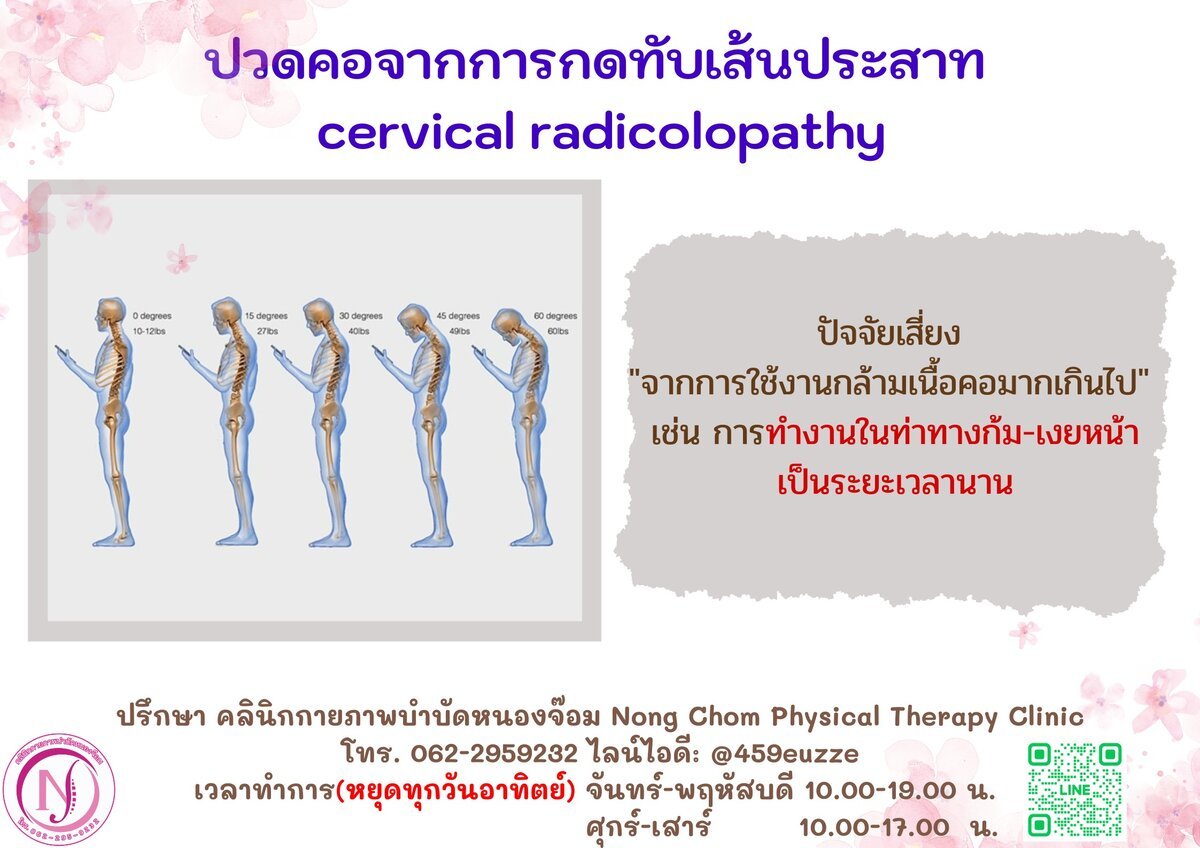 ปัจจัยเสี่ยงปวดคอ