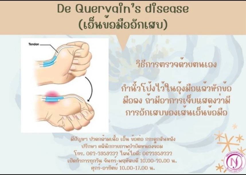 De Quervain's disease
