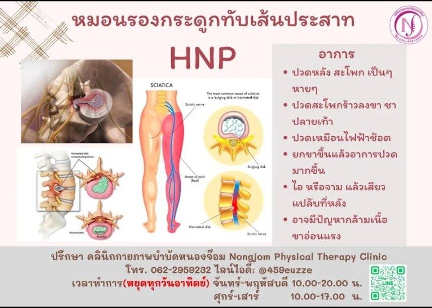 HNP