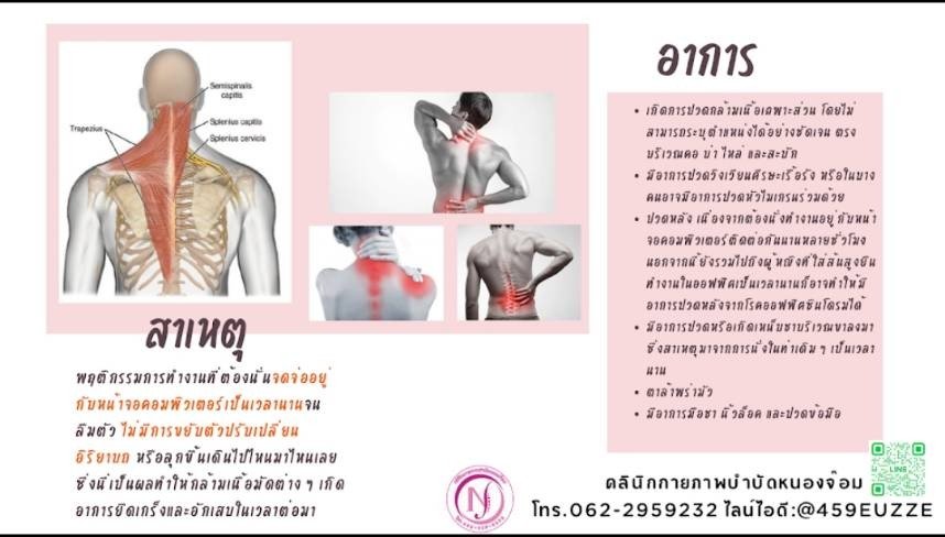 สาเหตุออฟฟิศซินโดรม