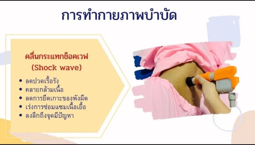 Shock Wave ลดปวดเรื้อรัง
