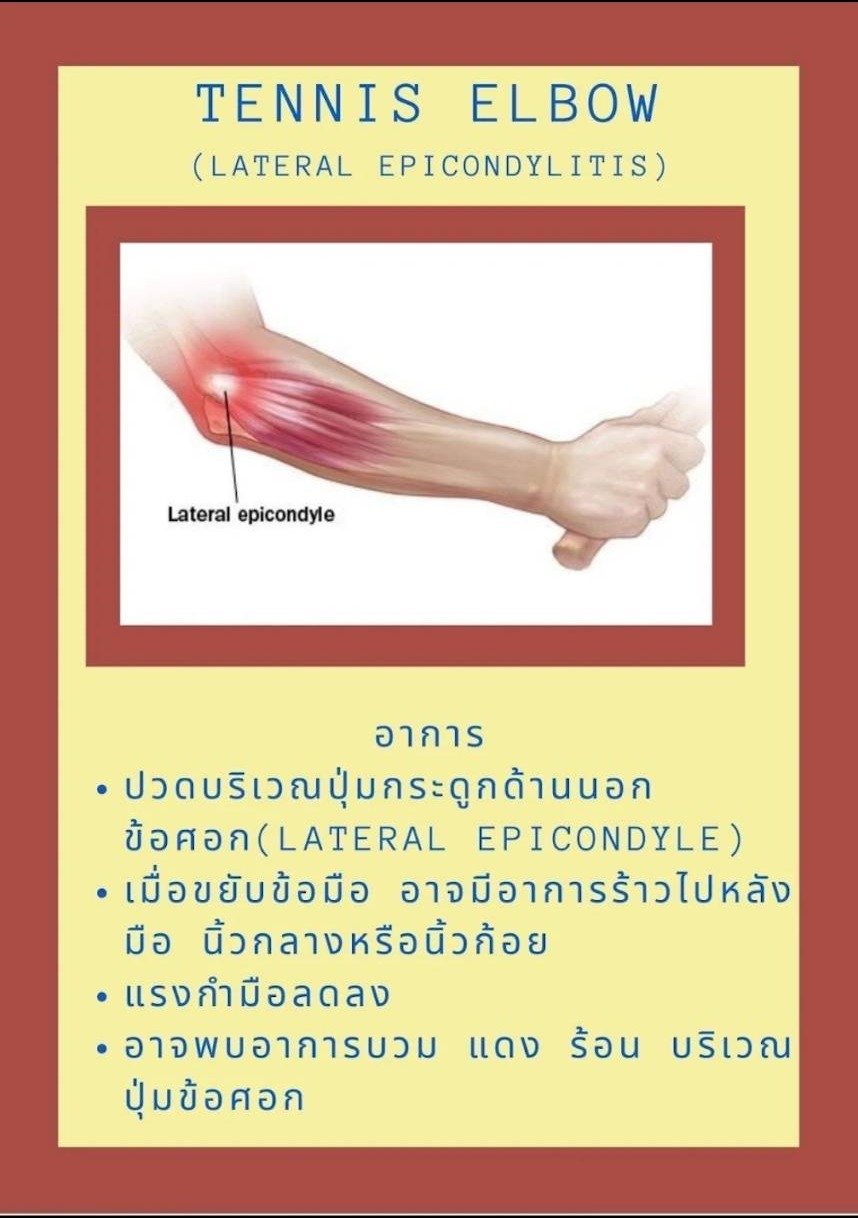 Tennis Elbow
